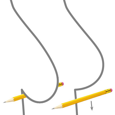 Brystløft og brystimplantater